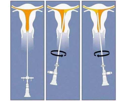 国内可以供卵试管的医院,女方有寻常型鱼鳞病做三代试管婴儿能避免遗传给后代吗？