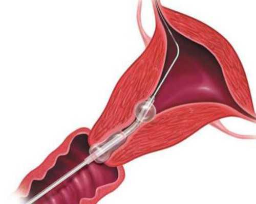 国内地下供卵电话,卵泡破裂前后同房生女孩不可信！想要怀女儿送你这3招						