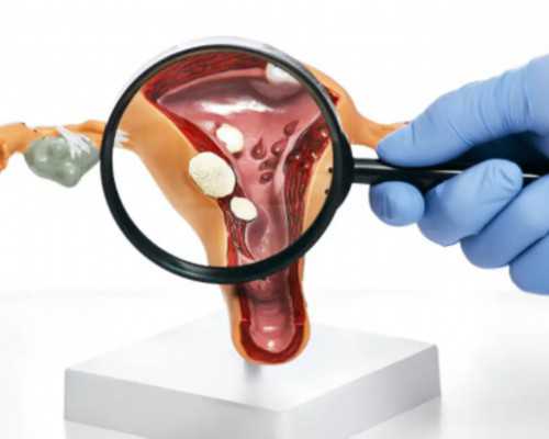 国内供卵试管的私立医院排名,弱精症做试管需要注意什么,要事先调理吗