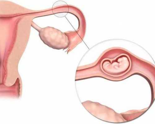 中国授权供卵机构,16号三体综合征是什么病？你想了解的原因、症状表现全在这里